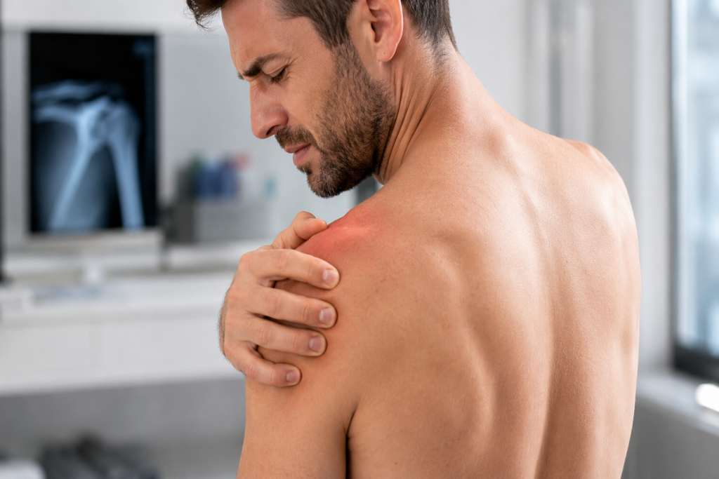 lussazione acromion claveare